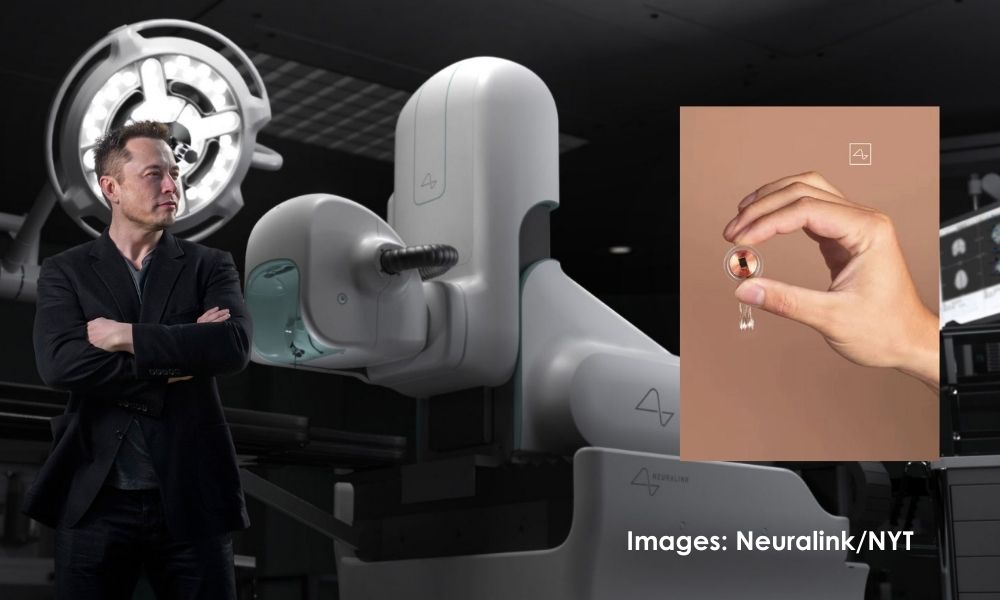 Nueralink brain impact by Elon Musk headed company